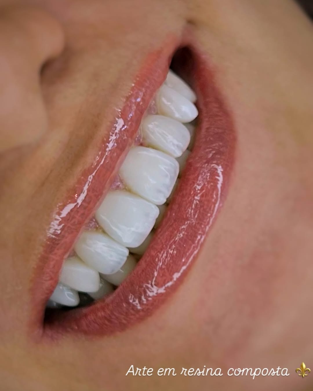 SaveClip.App_496210106_18503629945021363_5864737642038839486_n