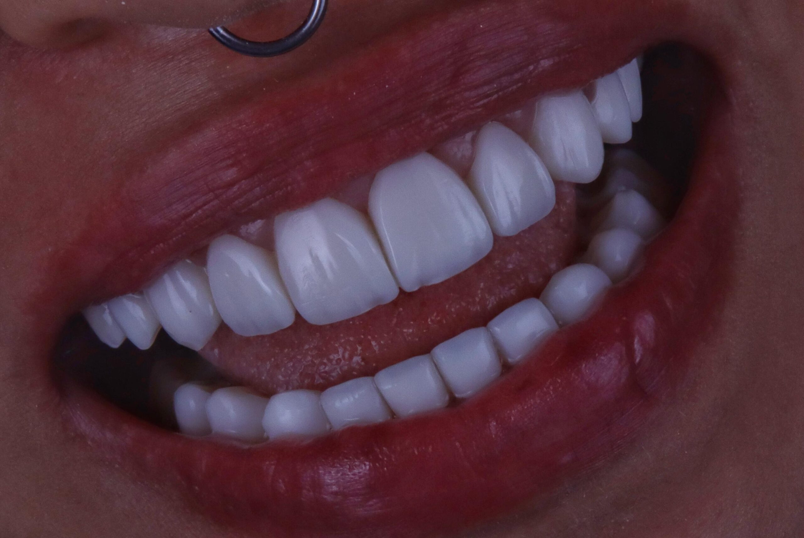 WhatsApp-Image-2025-07-15-at-10.56.28-scaled-2